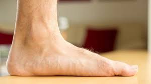  کف پای صاف چیست؟/ بهترین روش درمان خانگی کف پای صاف
