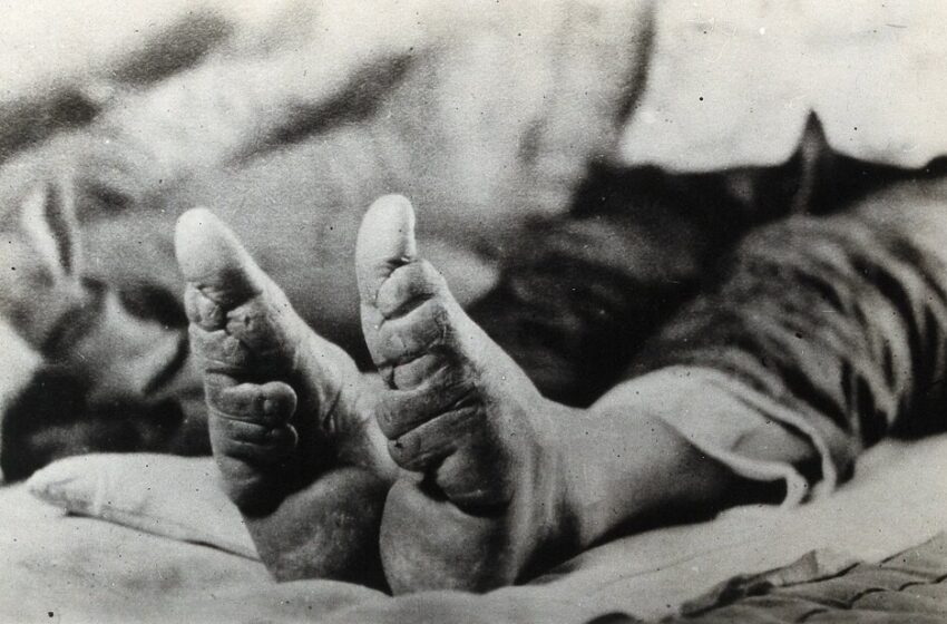  عکس | عجیب ترین سنت دردناک چینی برای تبدیل پاها به کفش!