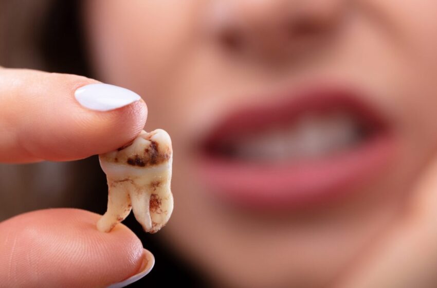  داروهایی که موجب پوسیدگی دندان و ضعیف شدن استخوان می‌شوند
