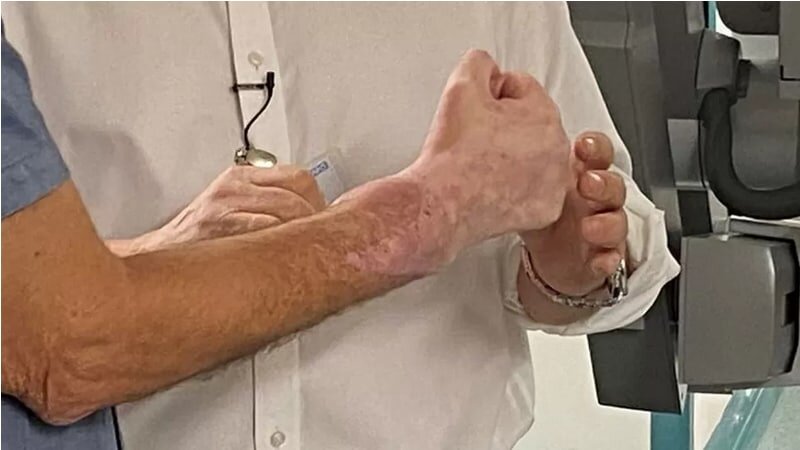  بیمار و جراح دست در دست هم؛ یک دهه پس از عمل تاریخی پیوند دست
