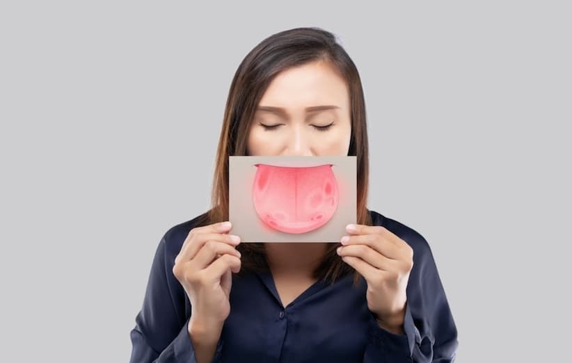  درمان آفت دهان با روش‌های سریع و خانگی