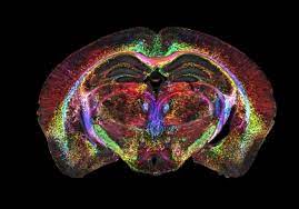 واضحترین عکس ازمغز