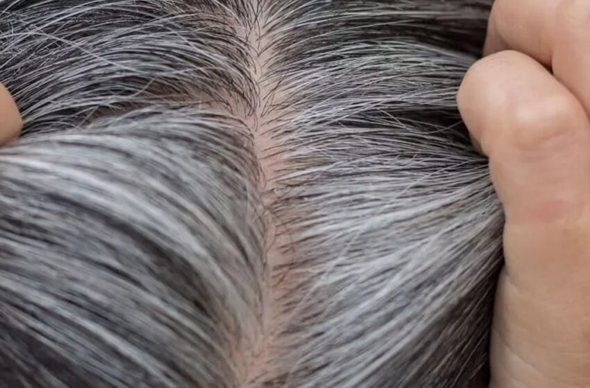 محققان دانشگاه کلمبیا شواهدی را یافتند که نشان می‌دهد استرس یکی از عوامل سفیدی موی انسان است و با از بین رفتن استرس می‌توان رنگ طبیعی موها را بازگرداند. کد خبر : ۶۳۷۱۸ به گزارش صد آنلاین ، در این تحقیقات ۴۰۰ تار مو از ۱۴ داوطلب گرفته شد و سپس با استفاده از یک تکنیک عکس‌برداری جدید وضعیت پروتئین‌های ملانین و کراتین و همچنین رنگدانه‌های موجود در بخش‌های مختلف هر تار مو مورد تجزیه و تحلیل قرار گرفت. در نتیجه این بررسی‌ها مشخص شد در برخی از تارهای مو به جای ریشه، قسمت نوک آن‌ها سفید شده است. این وضعیت نشان می‌دهد تار مو زمانی سفید شده و پس از مدتی مجددا رنگ اصلی خود را به دست آورده است. با توجه به این که سرعت رشد مو برای هر شخص قابل اندازه‌گیری است، محققان توانستند زمان آغاز سفیدی مو و همچنین زمان بازیابی رنگدانه طبیعی موهای هریک از داوطلبان را محاسبه کنند. سپس با استفاده از یک پرسشنامه، وقایع و شرایط استرس‌زایی را که داوطلبان در دوره شروع سفیدی مو تجربه کرده‌بودند، ‌ شناسایی کرده و تقارن زمانی این وقایع و شروع سفیدی مو را در بسیاری از آن‌ها تایید کردند. همچنین دریافتند شروع بازیابی رنگدانه طبیعی موی یکی از داوطلبان دقیقا همزمان با شروع یک دوره تفریحی برای وی آغاز شده است. خرید طلای بدون اجرت، حتی با 50 هزار تومان. با هر مبلغی طلا پس انداز کن تبلیغ خرید طلای بدون اجرت، حتی با 50 هزار تومان. با هر مبلغی طلا پس انداز کن عضویت رایگان yn-ad بر اساس نتایج این تحقیقات مشخص شد استرس واقعا می‌تواند موجب سفیدی موها شود و از بین رفتن عوامل استرس‌زا می‌تواند رنگ طبیعی موها را بازگرداند. همچنین مشخص شد این بازیابی رنگ تنها در مورد موهایی که به دلیل استرس سفید شده‌اند و در یک فاصله زمانی نسبت کوتاه پس از سفید شدن موها رخ می‌دهد.